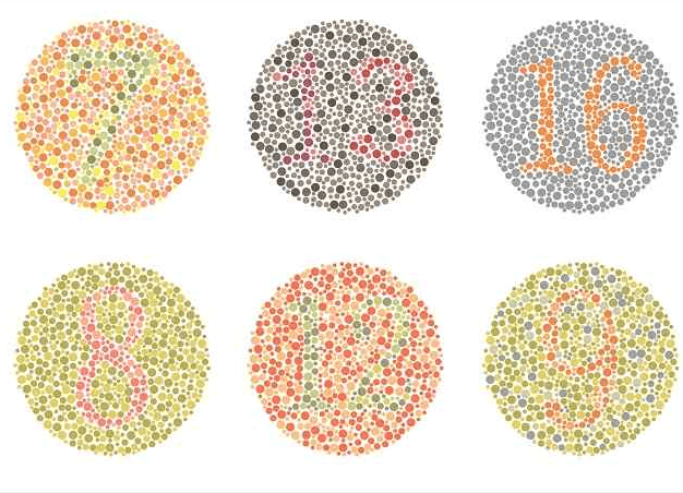 Kenali Buta Warna Parsial: Gangguan Penglihatan Warna yang Sering Tak Disadari