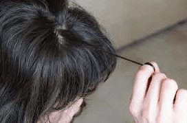 Mencabut Rambut Secara Berulang? Ini Solusi Efektif untuk Mengatasi Trikotilomania